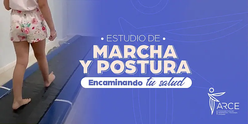 Estudio de marcha y postura en Clínica Arce para analizar la pisada y el apoyo del cuerpo